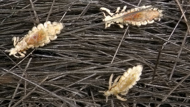 Is There An Effective New Option to Treat Head Lice?